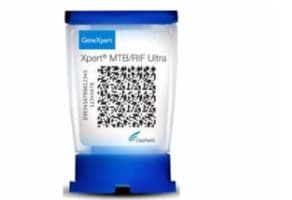 Kematian TBC di Indonesia Tinggi, Apa Karena DAK Kesehatan Dibekukan?